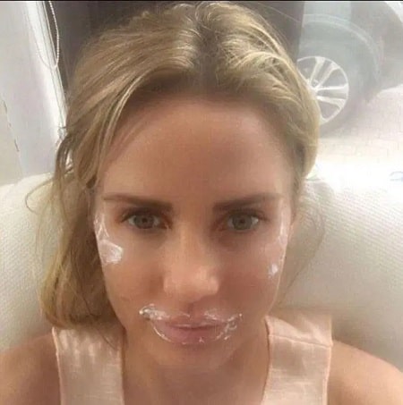 A picture of Katie Price during her Botox treatment.